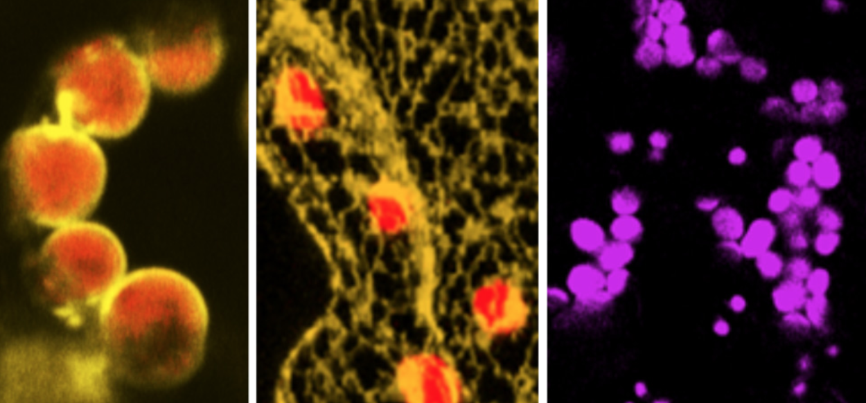 Confocal image of a tobacco leaf epidermal cell co-expressing a fluorescent ER marker (pseudocolored yellow) and a fluorescent marker that labels the chloroplasts (pseudo­colored red and magenta).  